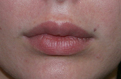 Фото до удаления геля