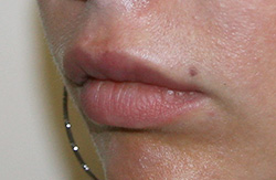 Фото после удаления геля