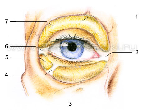 Блефаропластика