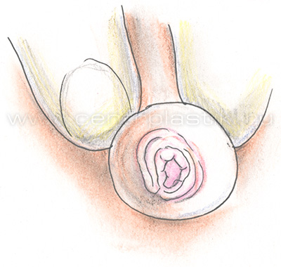 Норма. Фимоза нет