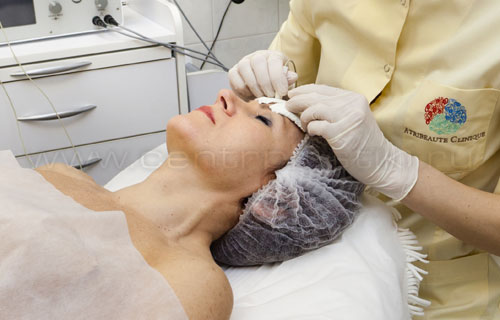 Электрофорез