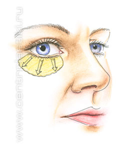 Операции на веках