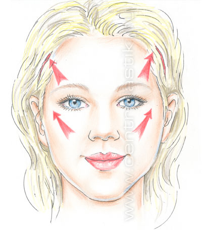 Эндоскопическая подтяжка лица