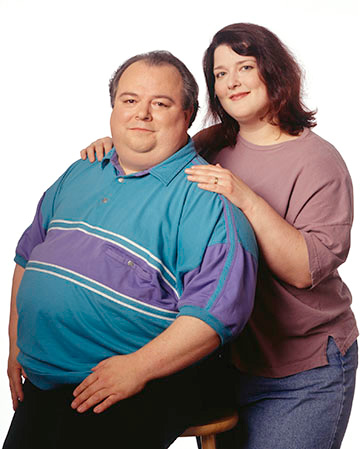 Лечение варикоза лазером