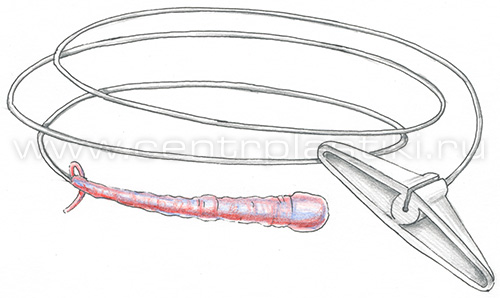 Флебэктомия