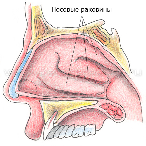 Вазомоторный ринит