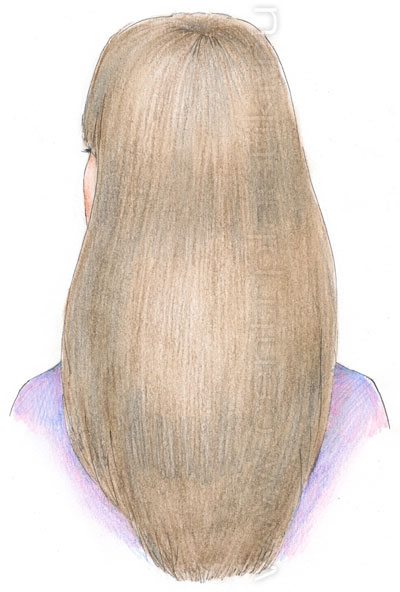 Мезотерапия волос