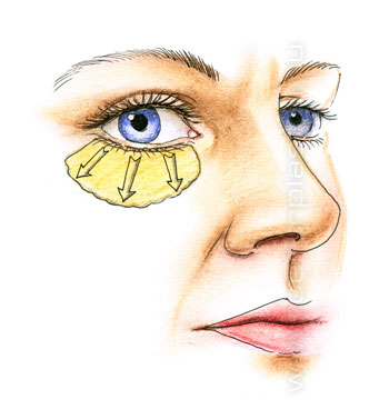 Подтяжка средней зоны лица