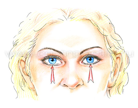 Подтяжка средней зоны лица