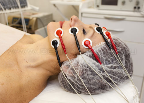 Миостимуляция