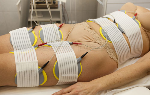 Миостимуляция