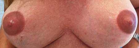 Перманентный макияж ареол