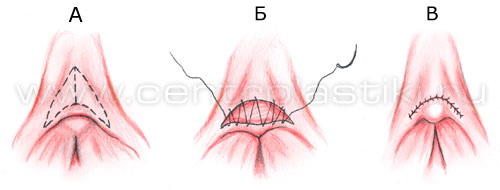 Половые губы