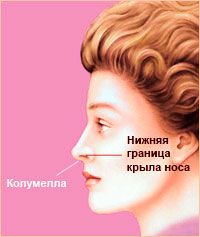 Пластика носа - Форма носа 7