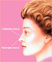 Пластика носа - Форма носа 8