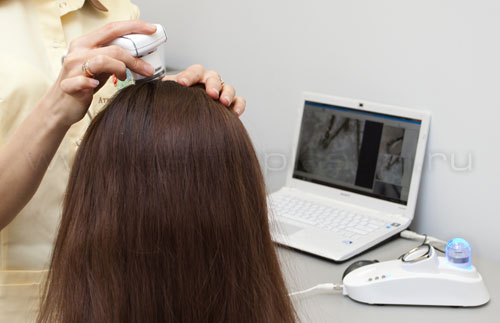 Компьютерная диагностика волос - Трихоскопия