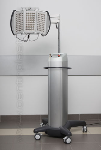 Лечение волос лазером