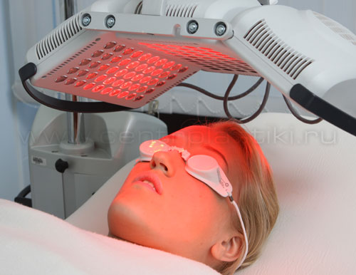 Лечение волос лазером