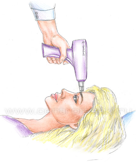 Процедура удаления перманентного макияжа