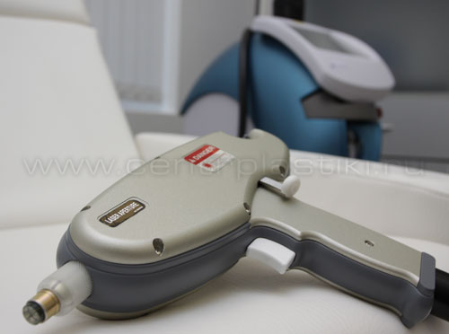 Удаление сосудов лазером