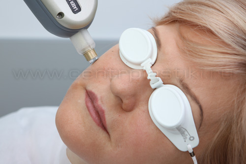 Удаление винных пятен