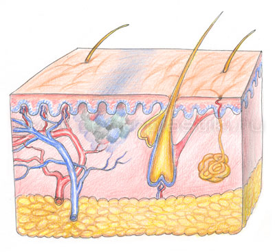 Удаление татуировки лазером