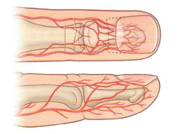 Вросший ноготь